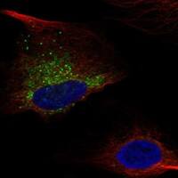 Immunocytochemistry/Immunofluorescence: Collagen I alpha 1 Antibody [NBP3-21230] -