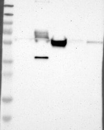 Western Blot: MAP2 Antibody [NBP3-21231] -