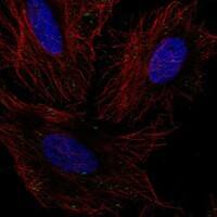 Immunocytochemistry/Immunofluorescence: GLT8D2 Antibody [NBP3-21232] -