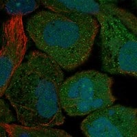 Immunocytochemistry/Immunofluorescence: GPER/GPR30 Antibody [NBP3-21238] -