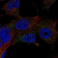 Immunocytochemistry/Immunofluorescence: Hexosaminidase A/HEXA Antibody [NBP3-21239] -