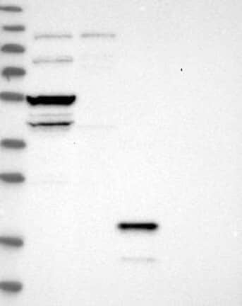 Western Blot: STARD3 Antibody [NBP3-21243] -