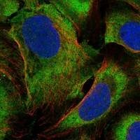 Immunocytochemistry/Immunofluorescence: Lipin 1 Antibody [NBP3-21244] -