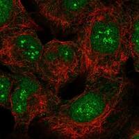 Immunocytochemistry/Immunofluorescence: SMUG1 Antibody [NBP3-21246] -