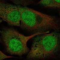 Immunocytochemistry/Immunofluorescence: UFD1L Antibody [NBP3-21251] -