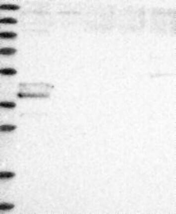 Western Blot: PAR4 Antibody [NBP3-21255] -