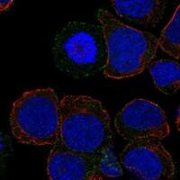 Immunocytochemistry/Immunofluorescence: ICOS Antibody [NBP3-21257] -