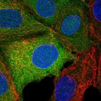 Immunocytochemistry/Immunofluorescence: TRPM7 Antibody [NBP3-21259] -