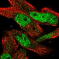 Immunocytochemistry/Immunofluorescence: INTS13 Antibody [NBP3-21263] -