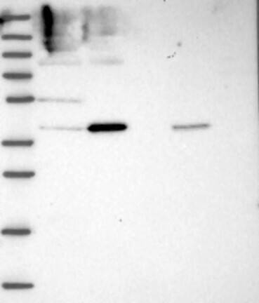 Western Blot: INTS13 Antibody [NBP3-21263] -