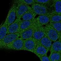 Immunocytochemistry/Immunofluorescence: PHLPP2 Antibody [NBP3-21264] -