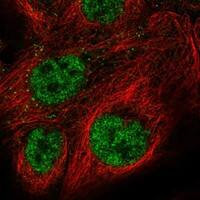 Immunocytochemistry/Immunofluorescence: PI 3-Kinase p110 beta/PIK3CB Antibody [NBP3-21265] -