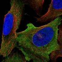 Immunocytochemistry/Immunofluorescence: Nav1.6 Antibody [NBP3-21269] -