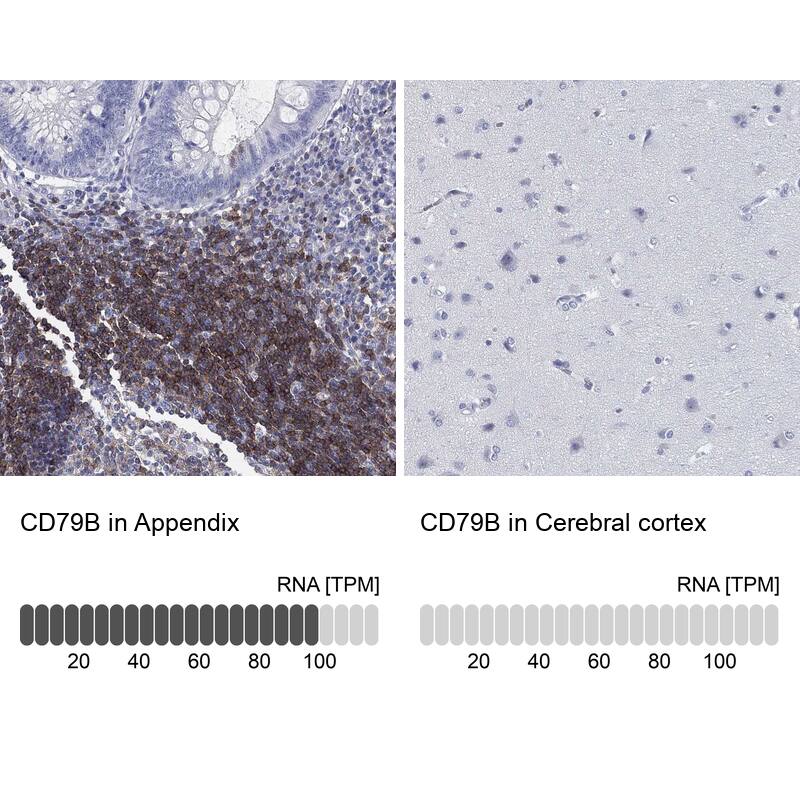 Immunohistochemistry-Paraffin: CD79B Antibody [NBP3-21270] -