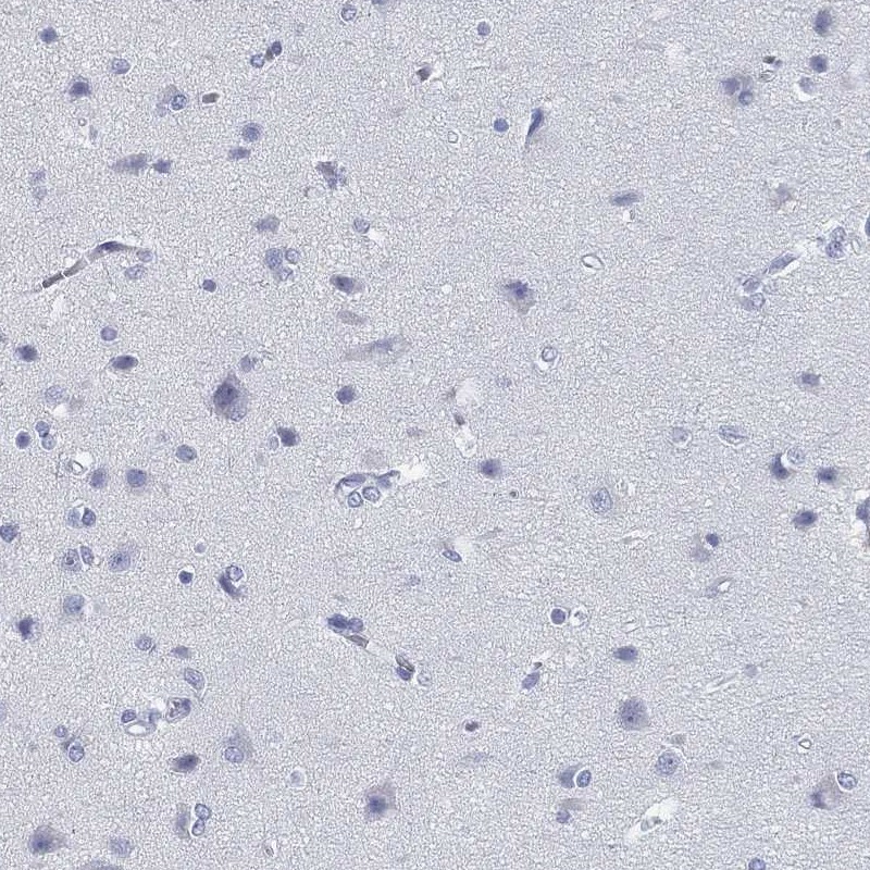 Immunohistochemistry-Paraffin: CD79B Antibody [NBP3-21270] -