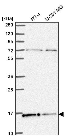 Western Blot: Histone H2AX Antibody [NBP3-21280] -