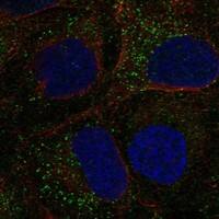 Immunocytochemistry/Immunofluorescence: CRIPTO Antibody [NBP3-21281] -