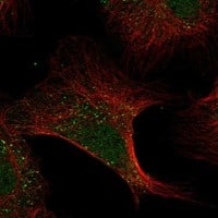 Immunocytochemistry/Immunofluorescence: ADAMTS13 Antibody [NBP3-21282] -