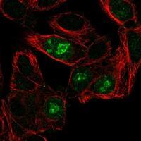 Immunocytochemistry/Immunofluorescence: Angiogenin Antibody [NBP3-21287] -