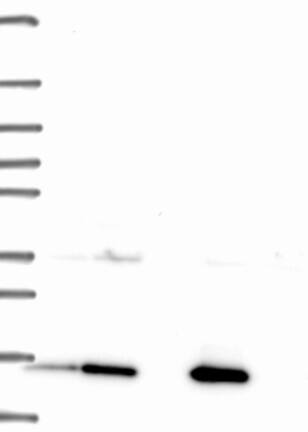 Western Blot: GCSH Antibody [NBP3-21289] -