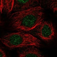 Immunocytochemistry/Immunofluorescence: ABH1 Antibody [NBP3-21292] -