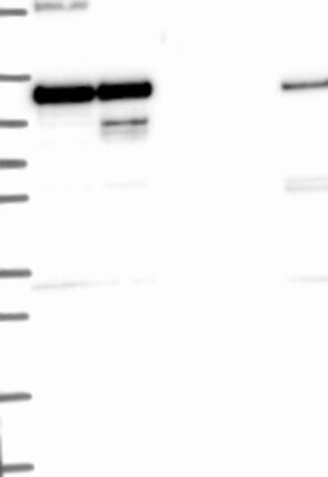 Western Blot: Hexokinase 2 Antibody [NBP3-21294] -