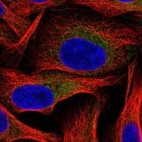 Immunocytochemistry/Immunofluorescence: Hexokinase 2 Antibody [NBP3-21294] -