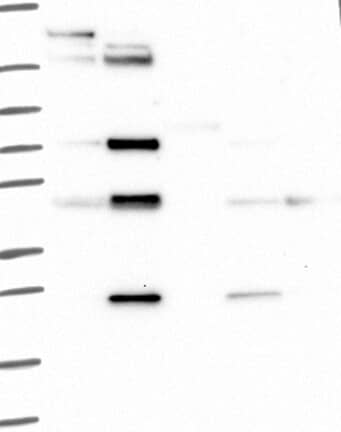 Western Blot: CD84/SLAMF5 Antibody [NBP3-21300] -