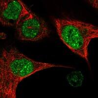 Immunocytochemistry/Immunofluorescence: TAF3B1 Antibody [NBP3-21302] -