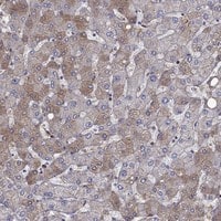 Immunohistochemistry-Paraffin: Hemopexin Antibody [NBP3-21306] -