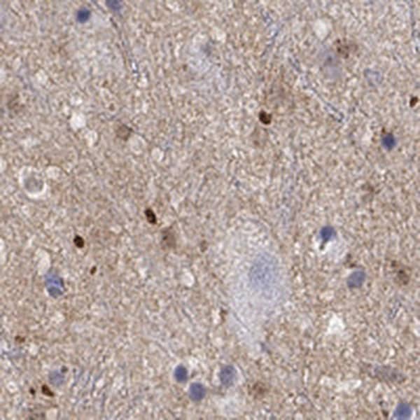 Immunohistochemistry-Paraffin: FGF basic/FGF2/bFGF Antibody [NBP3-21307] -