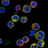 Immunocytochemistry/Immunofluorescence: IL-10R alpha Antibody [NBP3-21308] -