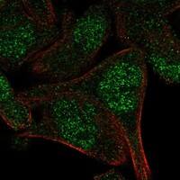 Immunocytochemistry/Immunofluorescence: APPBP2 Antibody [NBP3-21310] -