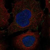 Immunocytochemistry/Immunofluorescence: IL-13R alpha 2 Antibody [NBP3-21312] -