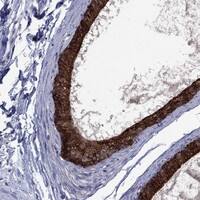 Immunohistochemistry-Paraffin: Furin Antibody [NBP3-21314] -