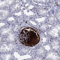 Immunohistochemistry-Paraffin: Vitronectin Antibody [NBP3-21315] -