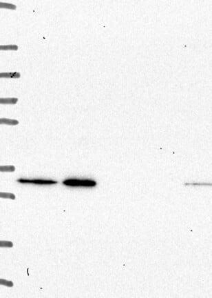 Western Blot: CD84/SLAMF5 Antibody [NBP3-21316] -