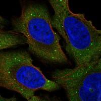 Immunocytochemistry/Immunofluorescence: eIF4E Antibody [NBP3-21317] -