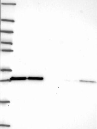 Western Blot: eIF4E Antibody [NBP3-21317] -