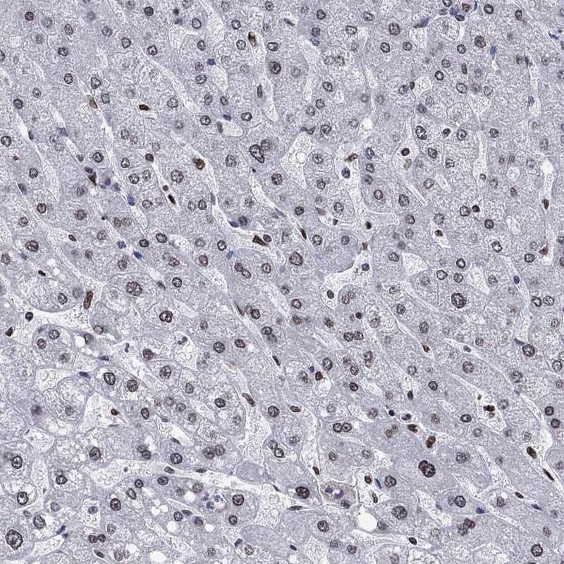 Immunohistochemistry-Paraffin: HMGA1 Antibody [NBP3-21318] -