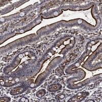 Immunohistochemistry-Paraffin: DPPIV/CD26 Antibody [NBP3-21319] -