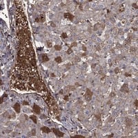 Immunohistochemistry-Paraffin: Hemopexin Antibody [NBP3-21321] -