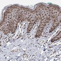 Immunohistochemistry-Paraffin: E4F1 Antibody [NBP3-21323] -