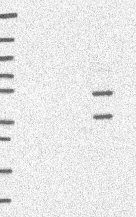 Western Blot: E4F1 Antibody [NBP3-21323] -