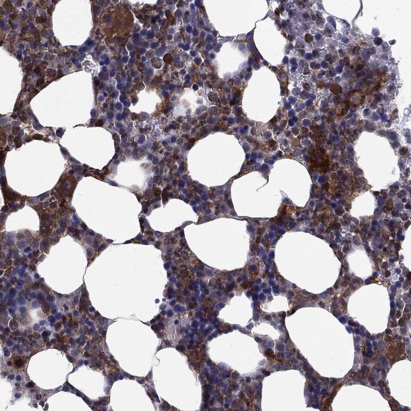 Immunohistochemistry-Paraffin: Phospholipase C beta 2 Antibody [NBP3-21325] -