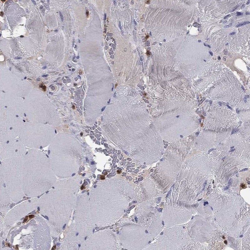 Immunohistochemistry-Paraffin: Phospholipase C beta 2 Antibody [NBP3-21325] -