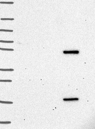 Western Blot: Carm1 Antibody [NBP3-21326] -