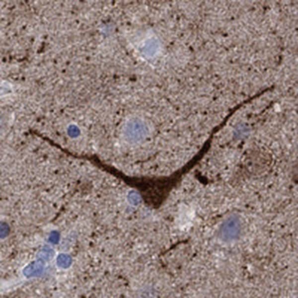 Immunohistochemistry-Paraffin: nNOS Antibody [NBP3-21327] -