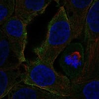 Immunocytochemistry/Immunofluorescence: CCR3 Antibody [NBP3-21328] -