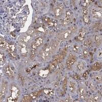 Immunohistochemistry-Paraffin: Ephrin-A1 Antibody [NBP3-21329] -